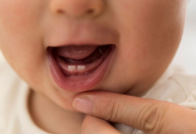 Bebeklerde Diş Çıkarma Belirtileri ve Başa Çıkma Yolları